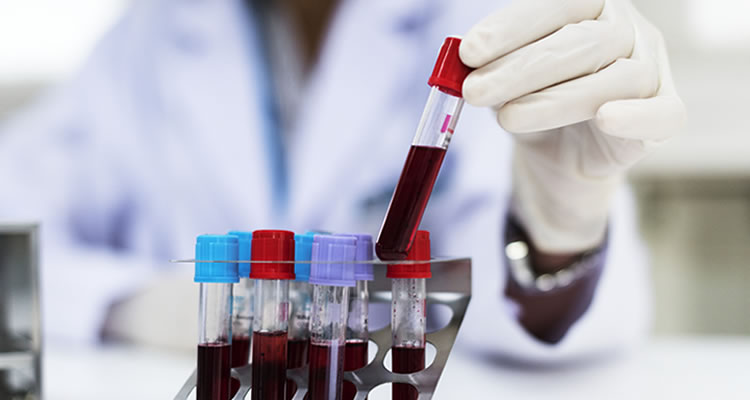 Blood: the future of cancer diagnosis? - Science Weekly podcast