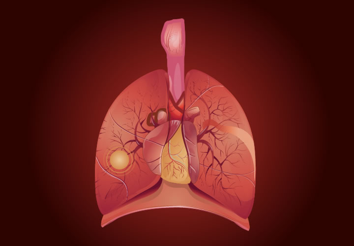 Updated 2019 ESC Guidelines for the diagnosis of acute pulmonary embolism in collaboration with ERS - Has learning from DiPEP been overlooked?