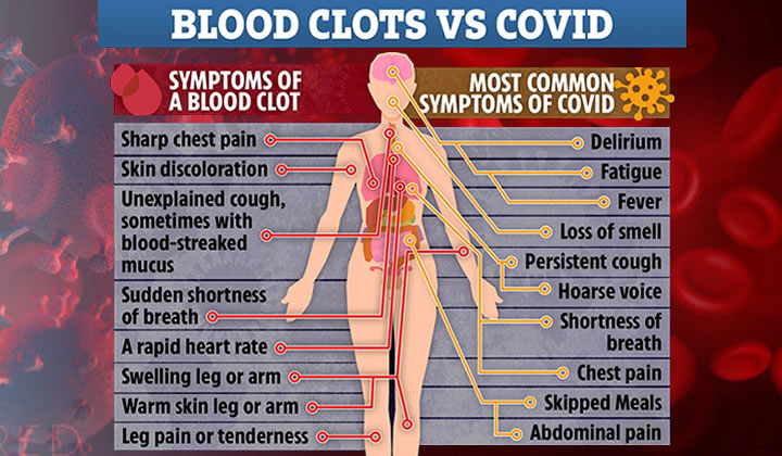 Thrombosis in the news - DEADLY blood clots are being mistaken for COVID, doctors have warned, as cases are reported that some symptoms of blood clots are wrongly being blamed on COVID-19.