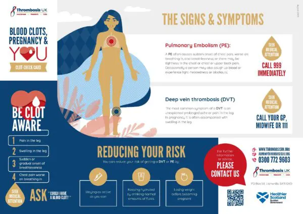 VTE prevention and pregnancy A4 double-sided fact sheet